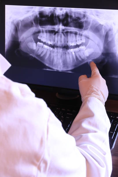 Best Emergency Dental Care for Broken or Chipped Teeth in Mission Bend, TX